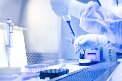 Research & Development Research & Development